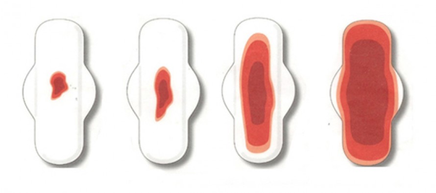 обильные месячные