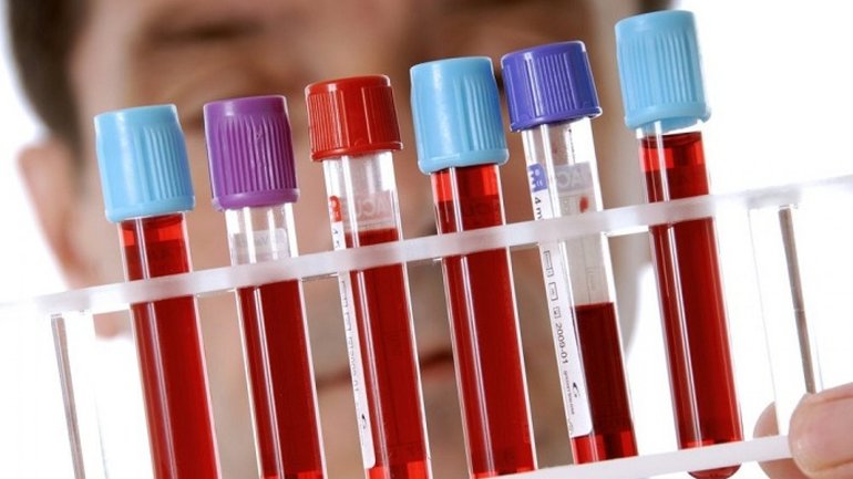 Общий анализ крови