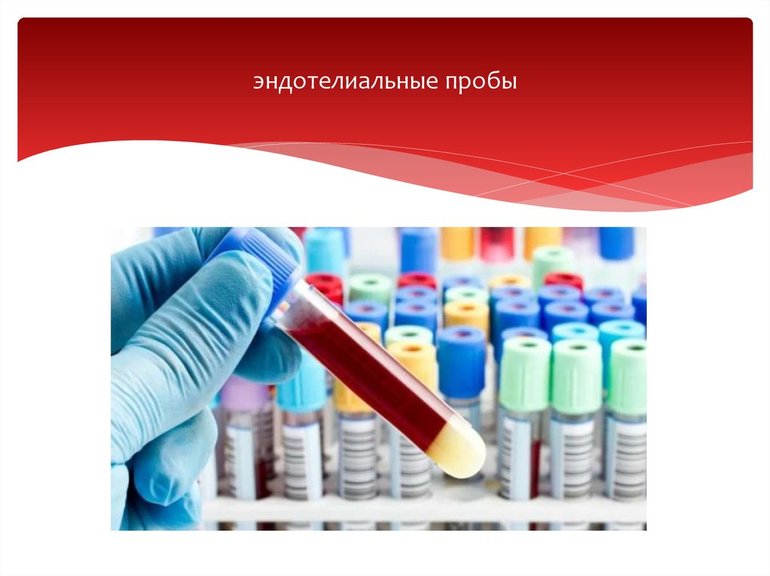 Обследования при иммунной тромбоцитопенической пурпуры