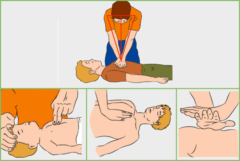 Оказание первой помощи