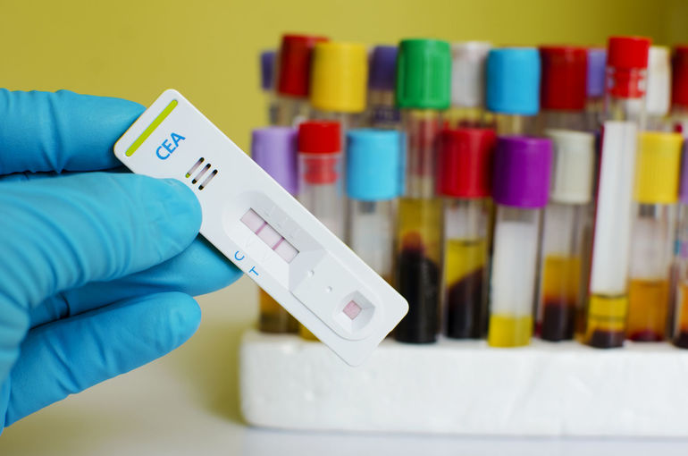 Онкомаркер