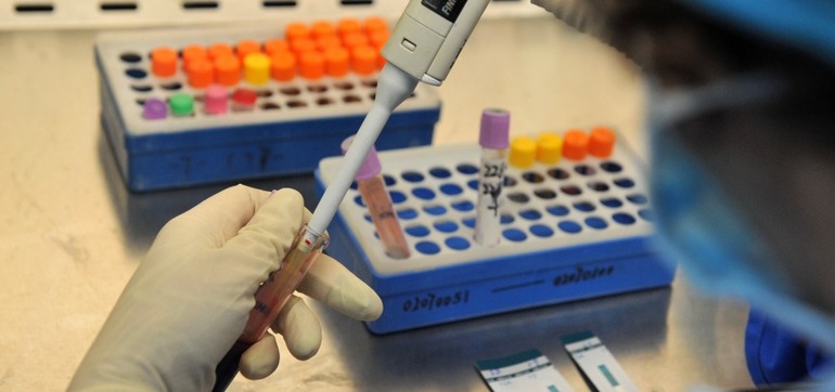 Онкомаркер са 125