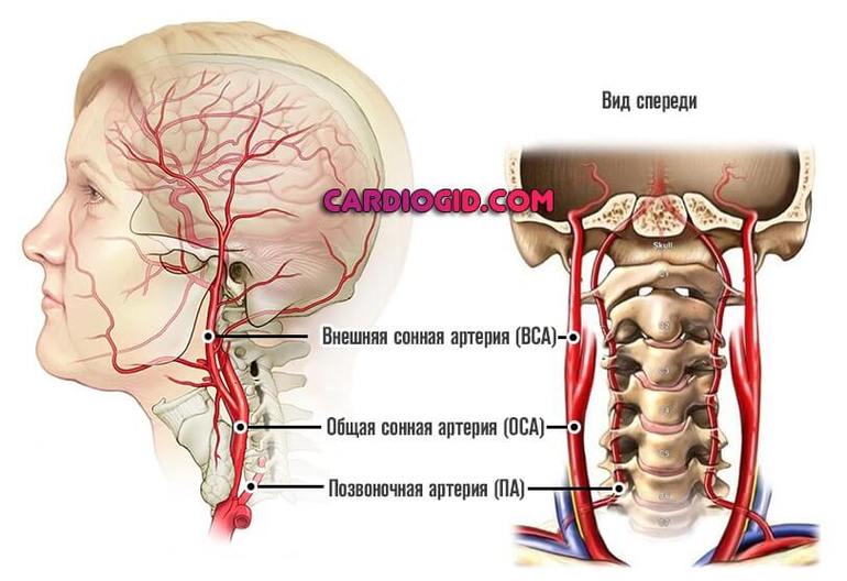 Опасность повреждения сонной артерии