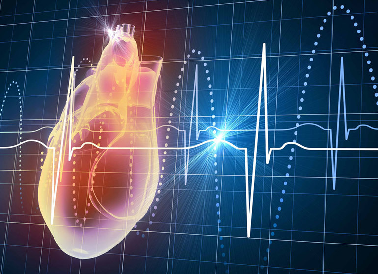 Ортостатическая тахикардия