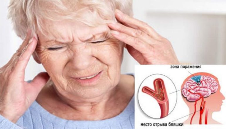 Осложнения и последствия