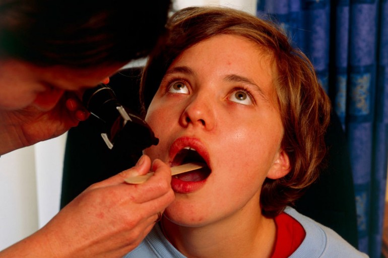 Осложнения тонзиллита