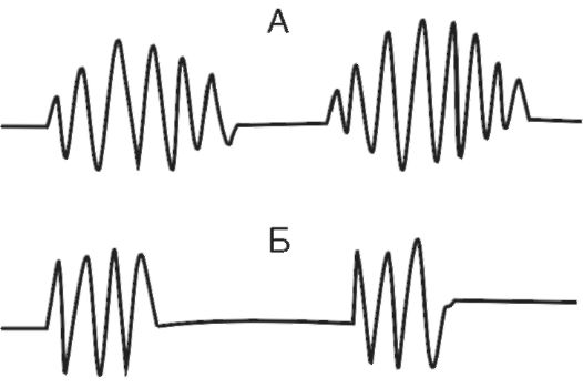 Патологические шумы при прослушивании