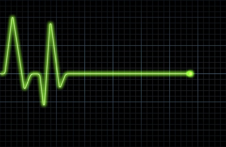 Первичная остановка сердца