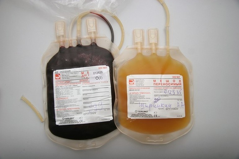 Плазма крови