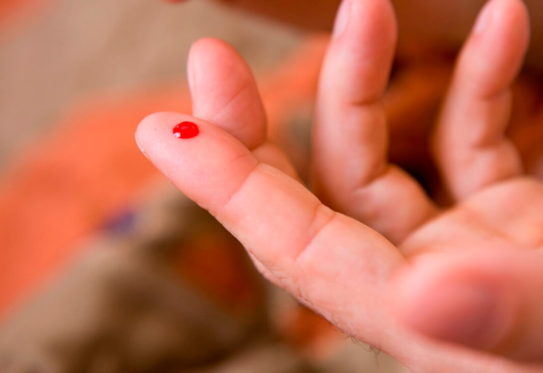 плохо сворачивается кровь