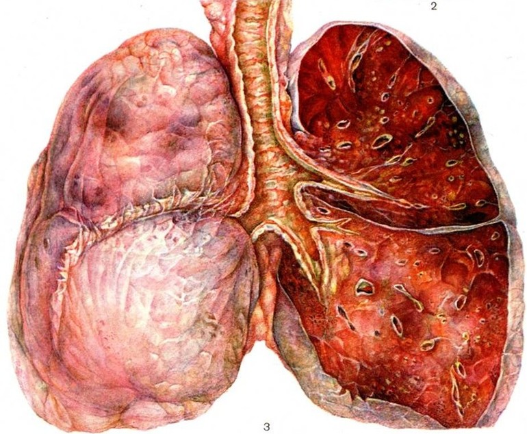 Побочные действия препаратов
