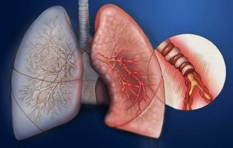 Почему болит в грудине