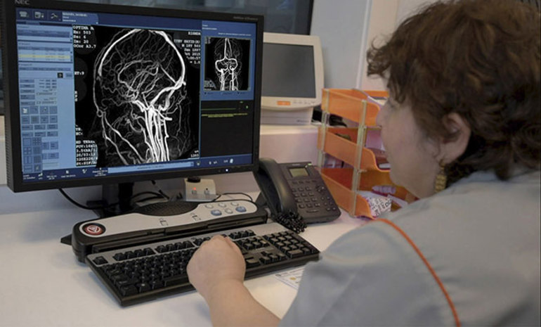 Показания для диагностики артерий и вен