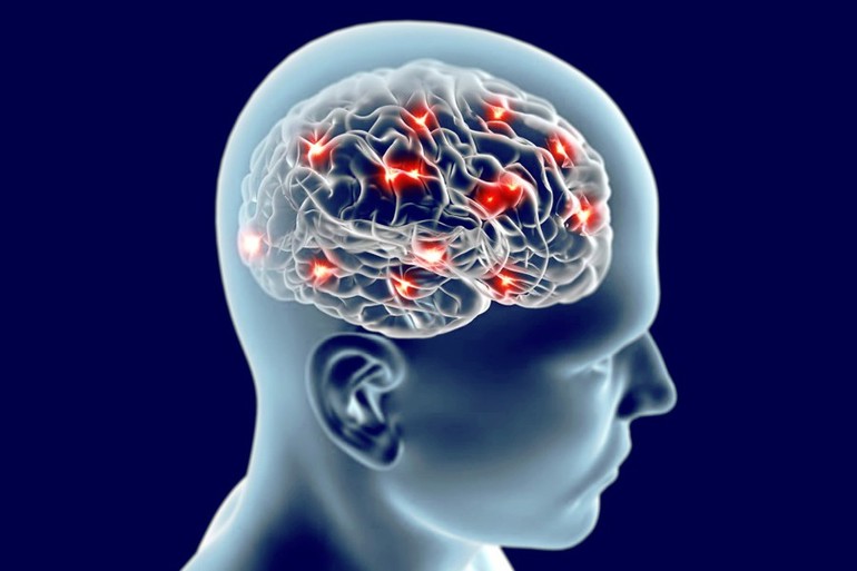 Показания для проведения РЭГ сосудов головного мозга