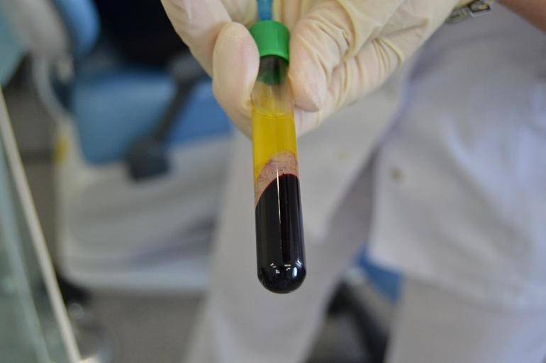 Показания к проведению аутогемотерапии