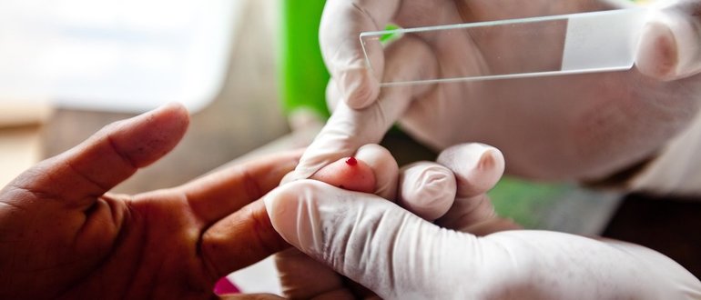 показатель соэ при онкологии