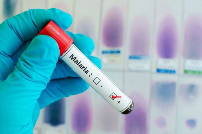 Показатели ретикулоцитов