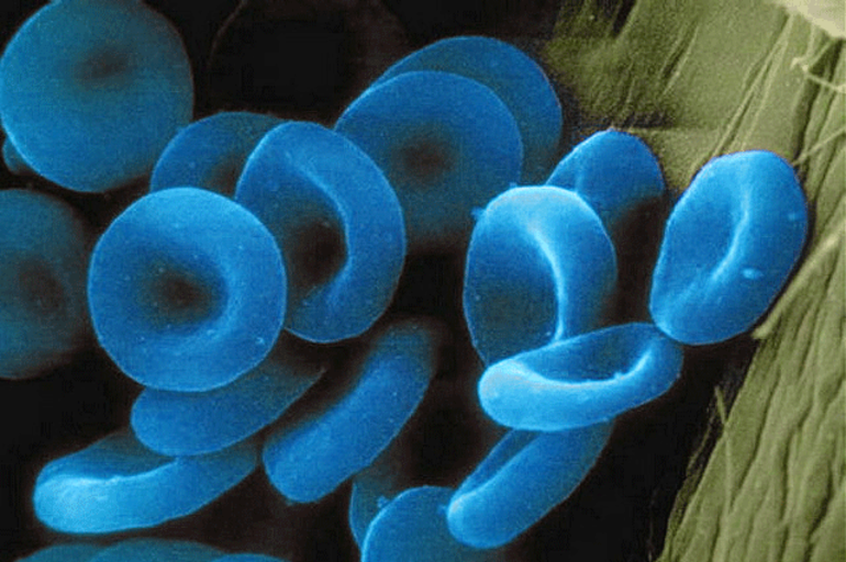 Понятие «голубая кровь»