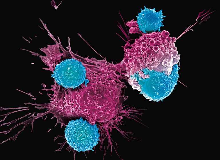 Понятие о лимфоцитах