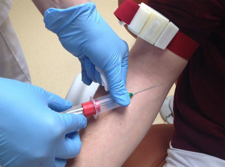 Порядок забор крови