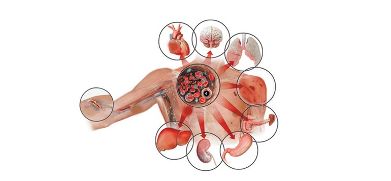 Последствия мочевины в крови