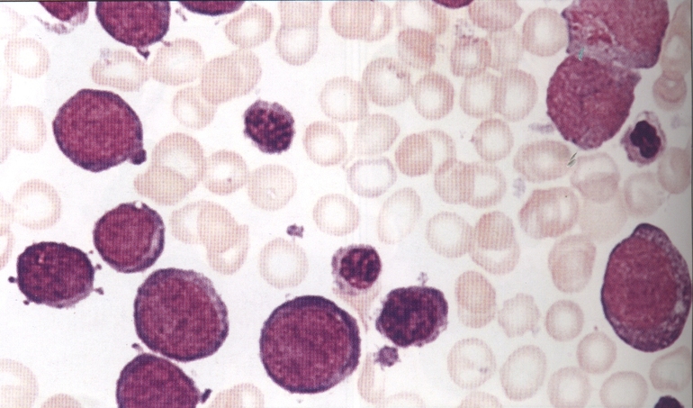 Прародителем эозинофилов выступает миелоидная клетка,