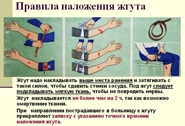 pravila nalozhenija zguta