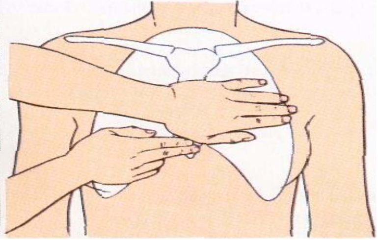 Прекардиальный удар