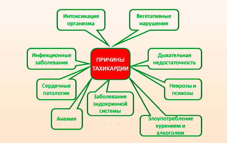 причины тахикардии