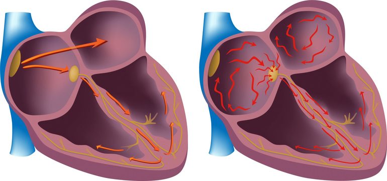 Причины кардиогенного шока