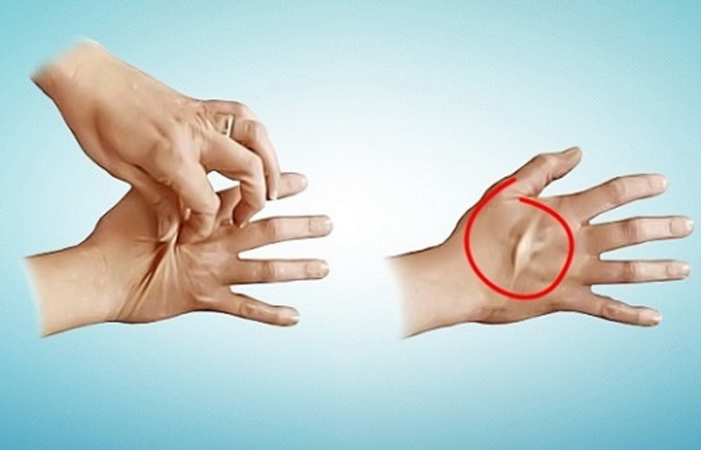 Причины низкого уровня гемоглобина