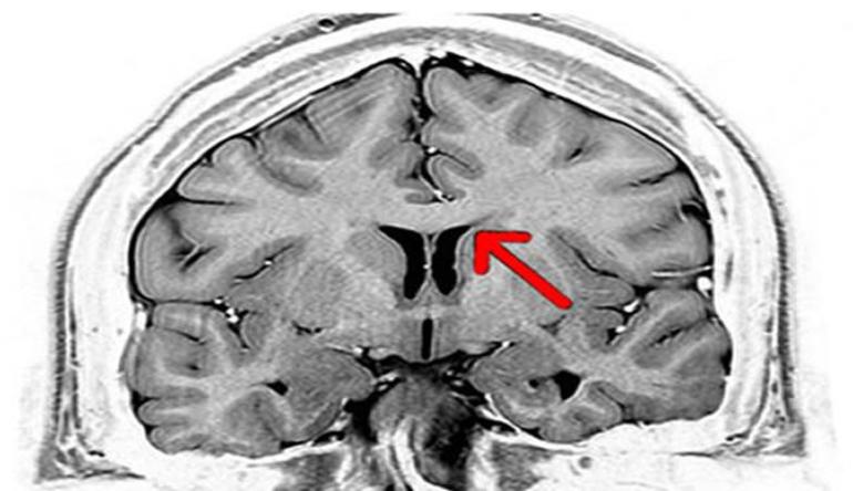 Причины патологии