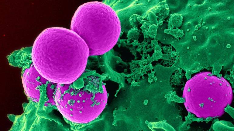 Причины повышения