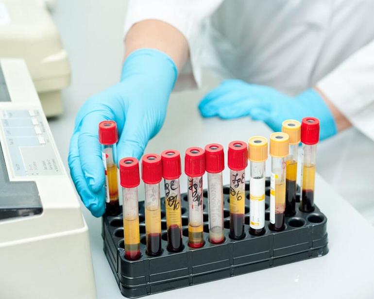 Причины повышенных лимфоциты в крови у ребенка