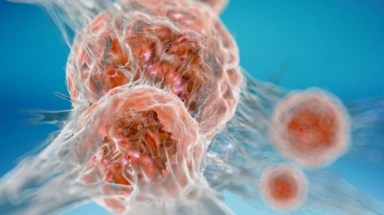 Причины развития заболевания