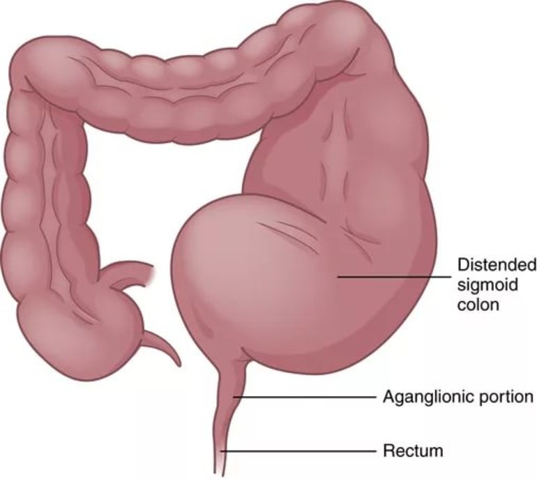 Причины развития заболевания