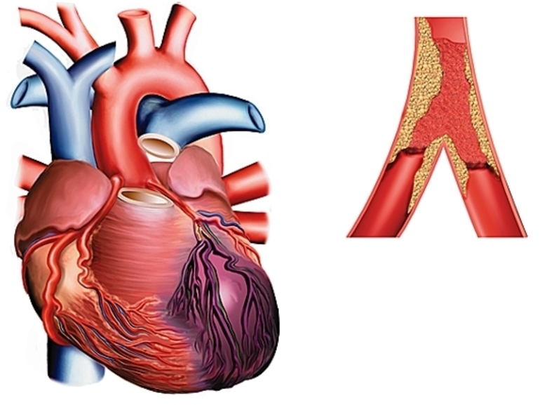 Причины учащенного пульса