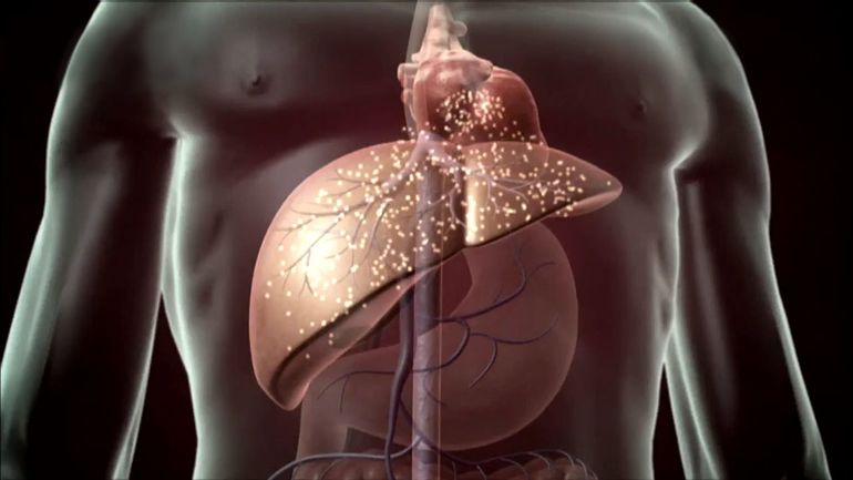 Причины заболевания печени