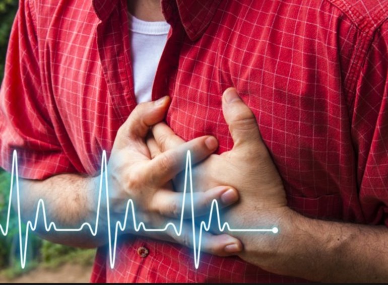 Приступы стенокардии