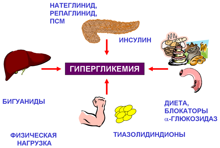 Признаки гипергликемической комы