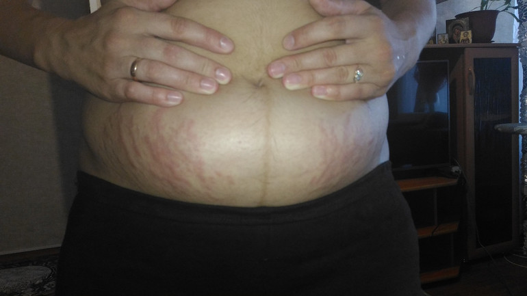 Признаки заболеваний сердца