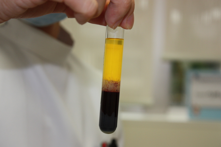 Пробирка с анализом