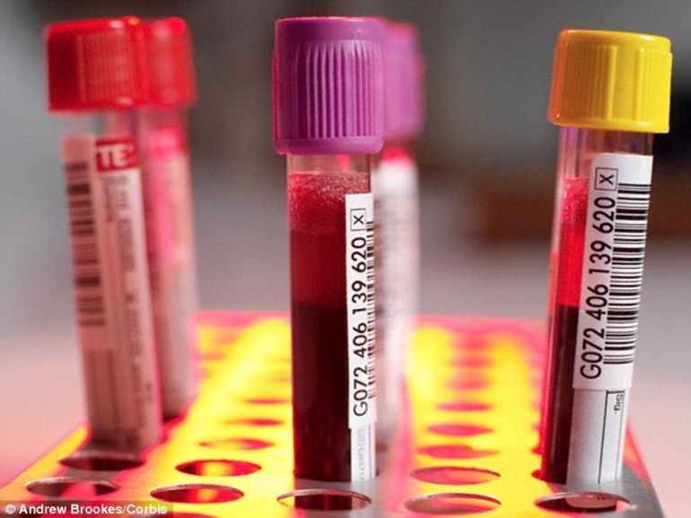 Пробирки крови