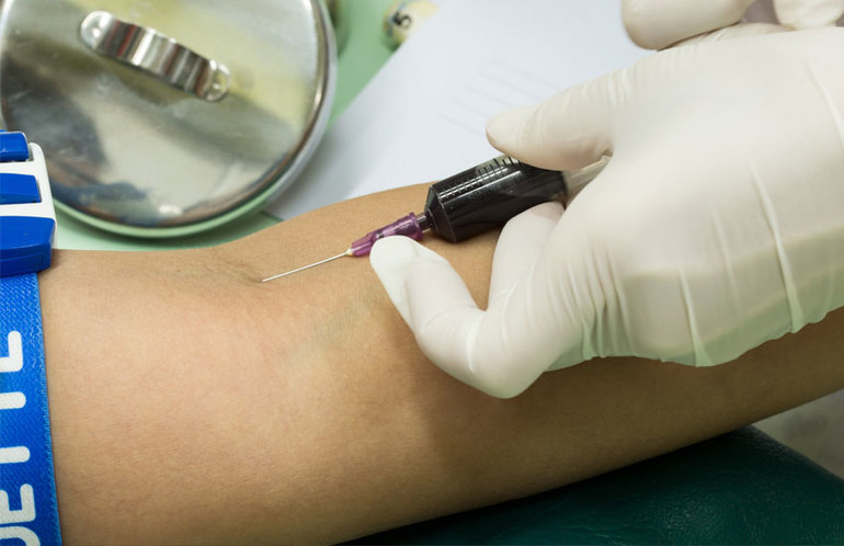 Процедура аутогемотерапия