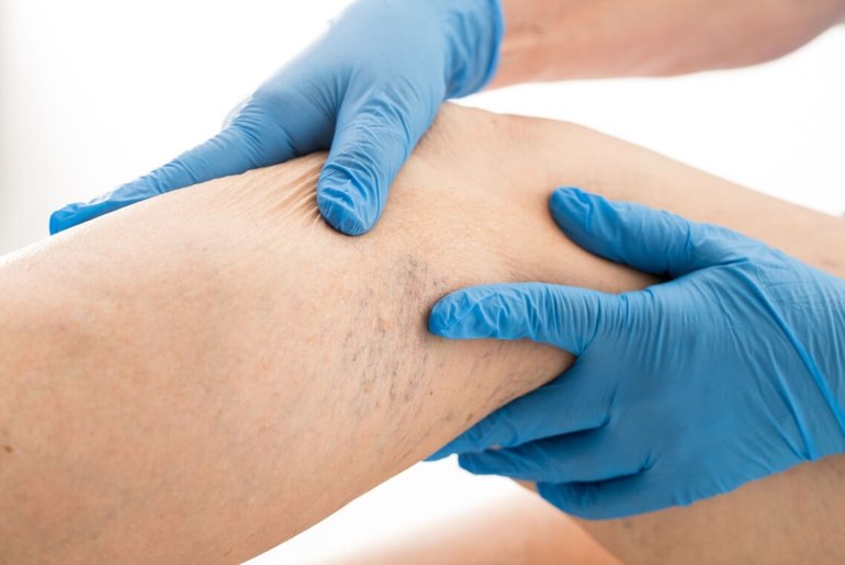 Профилактические мероприятия