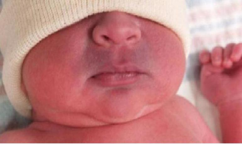 Прогноз и профилактика