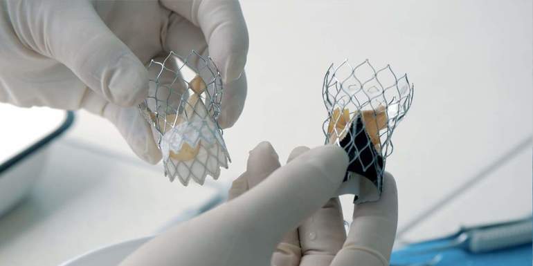 Протезирование сердечного клапана