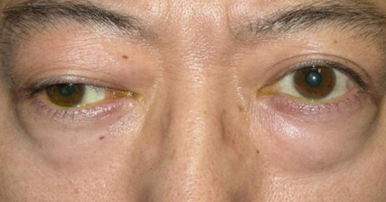 Противопоказания к препарату