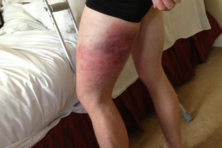 Противопоказания к процедуре