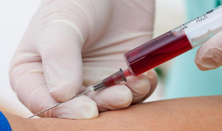 протромбиновый индекс по квику